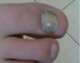 ���ֻ�ָ�׺�Ӧ����ô����