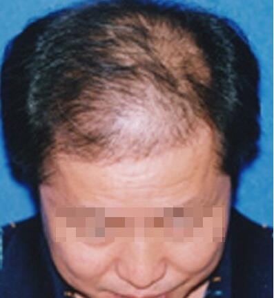 ֬�����ѷ����ճ�����ע��ʲô