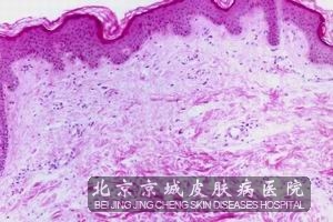 ݡ����ļ��㲡��