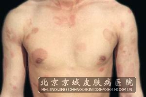 ����ݡ������ô����