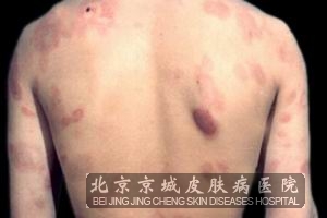 ݡ����֢״����Щ����