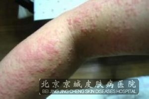 ��������ݡ�������Ԥ��