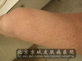 �������۲��ĽϺ÷���