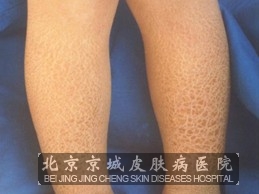 ��������������۲�