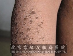 �������۲��� ��