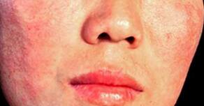 Ԥ������Ƥ��������ʩ