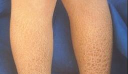 ���۲��ĳ���֢״����