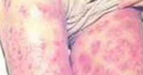 ʹüҪ