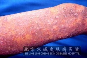 Ѫݡô
