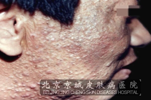 Ԥ���������Ҫ��ʲô