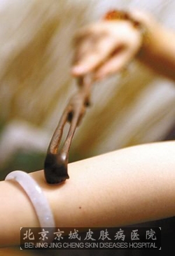 面对过敏性皮肤瘙痒如何护理