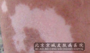 绤شʩ
