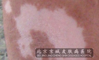 类ԭʲô