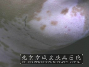 绤شʩЩ