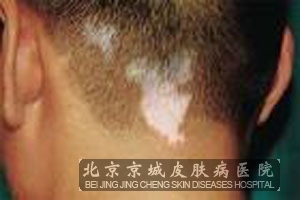 粻Ƶԭ