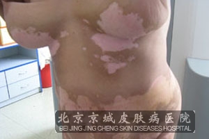 Ӧô