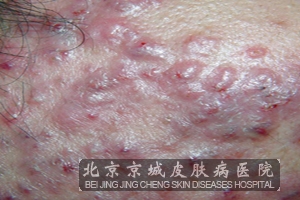 �������ҩ�����