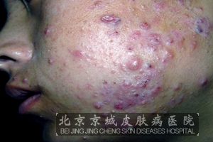 ŧ�����Ӧ����ôԤ����