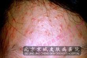 ���������ôԤ����