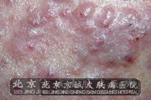 ���Ԥ������������Щ