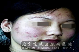 ר�ҽ�����̺����γɵ�