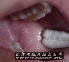 Ԥƽ̦޺