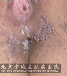 Ըô
