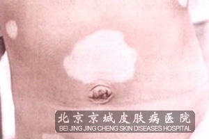 ͯ综ߵʳҪʲô