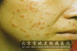 沿Ƥ֢״ͼƬ
