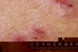 沿Ƥô