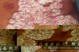 ţƤѢ