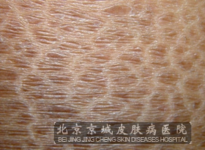 广大患者认可的全国皮肤病医院排名