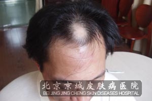生姜脱发脂溢性治疗--廊坊新闻网猪肝和猪湿图片