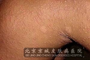 õ忷ͼƬ