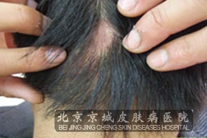 <em>梦见掉头发</em>是<em>怎么回事</em>--廊坊新闻网