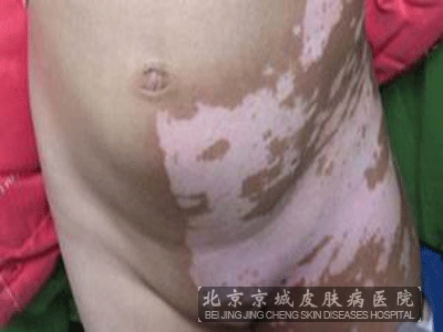 糣֢״Щ