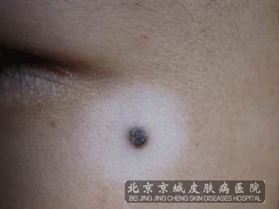 综Ӧעʲô