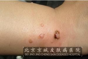 刺猴初期图片