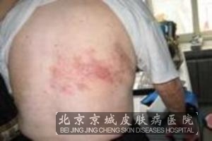 ��״����Ҫ��ôԤ����