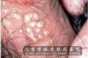 ������ֳ������Ҫ��ô������