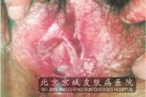 ��ֳ������ķ���ԭ������Щ