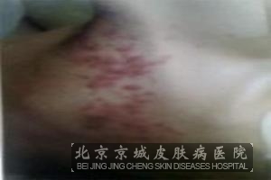 ���ƴ�״�����ע����������Щ