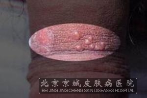 ��ֳ������Ĵ�����ʽ����Щ