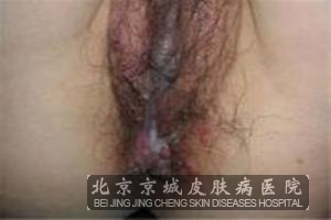 ��ֳ�������Ҫ��ô���һ�����