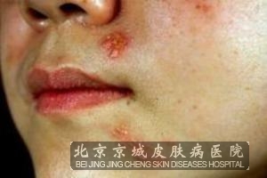 ��״�����ע����������Щ