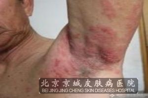 ��״�����֢״����ô������