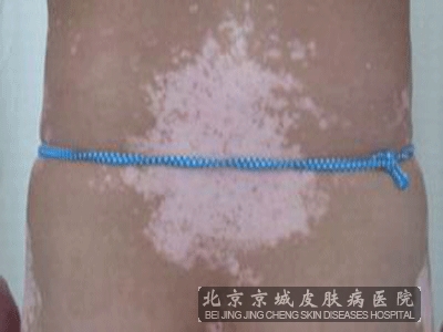 绤ҪעЩ