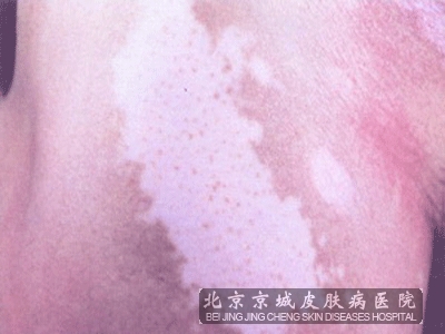 ưŲḴ