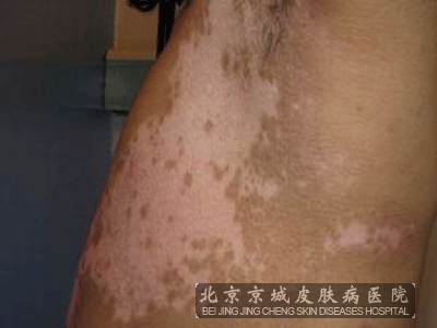综λ