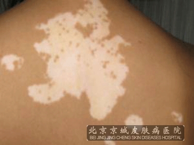 緢Щ